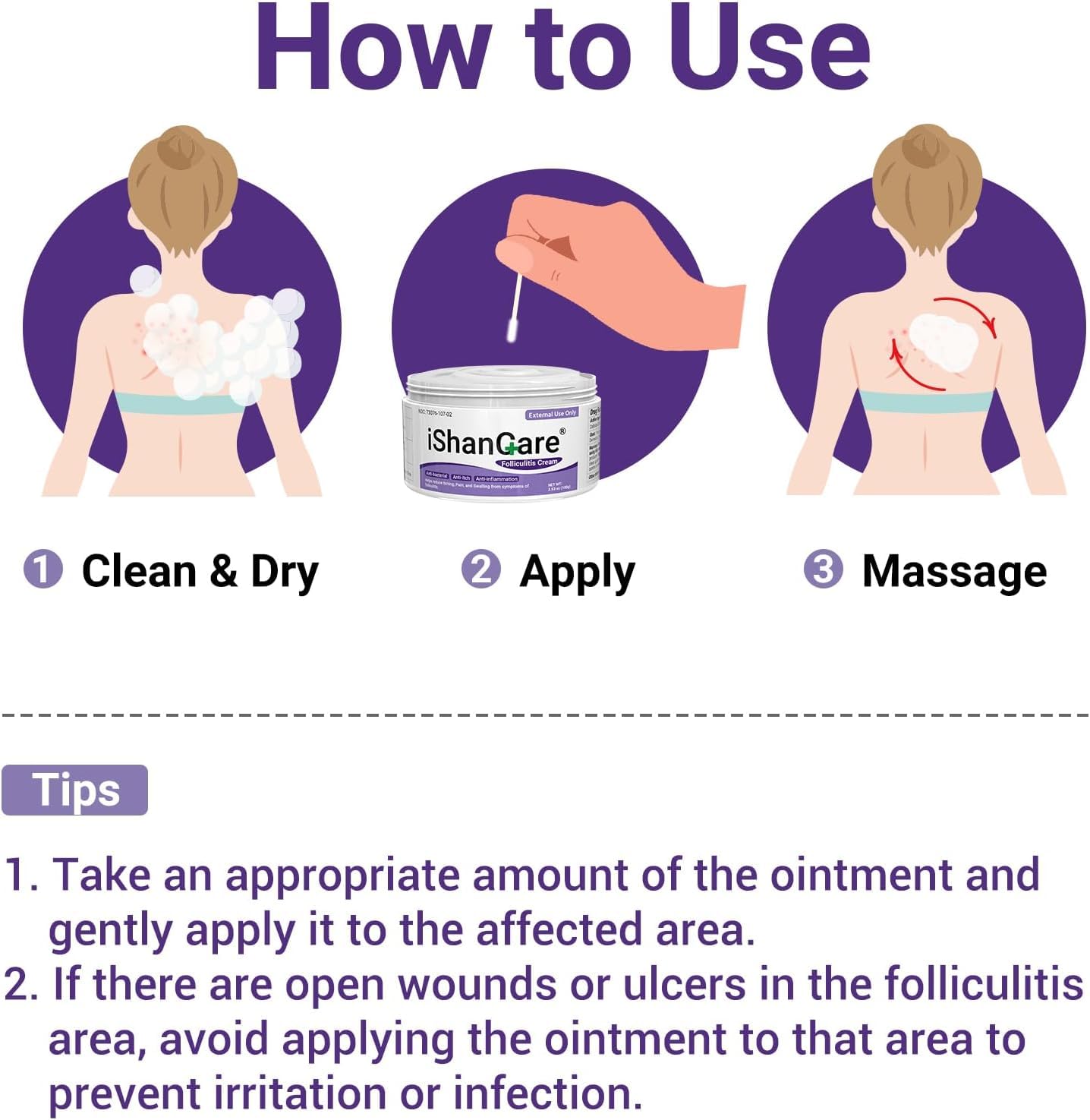 IShanCare Follikulitis-Behandlungscreme, natürlich, antibakteriell, gegen Juckreiz, Rötung, Entzündung, Schmerzen, Brennen, 100 g