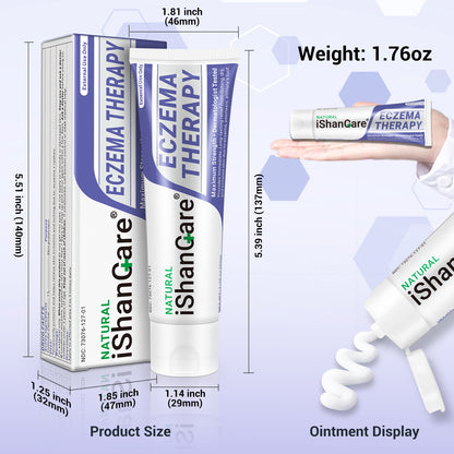 iShanCare® Eczema Cream, Maximum Strength Treatment Ointment for Psoriasis, Dermatitis, Rash, Infection, Jock Itch, Athletes Foot, Anti Itch, Relief for Redness, Irritated Skin, 1.77 Oz