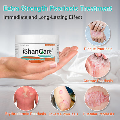 ishancare Psoriasis Cream, Potent Moisturizing Treatment Ointment for Psoriasis, Dermatitis & Rashes, Relief from Itching, Redness, Flaking & Scaling, Quick-Acting Soothing Cream for Dry Skin 3.53oz
