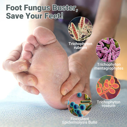 ishancare Extra Strength Antifungal Foot Cream (0.7oz) - Natural Herbal Treatment for Athlete's Foot - Relieves Itching, Burning, Cracking & Fungal Infections