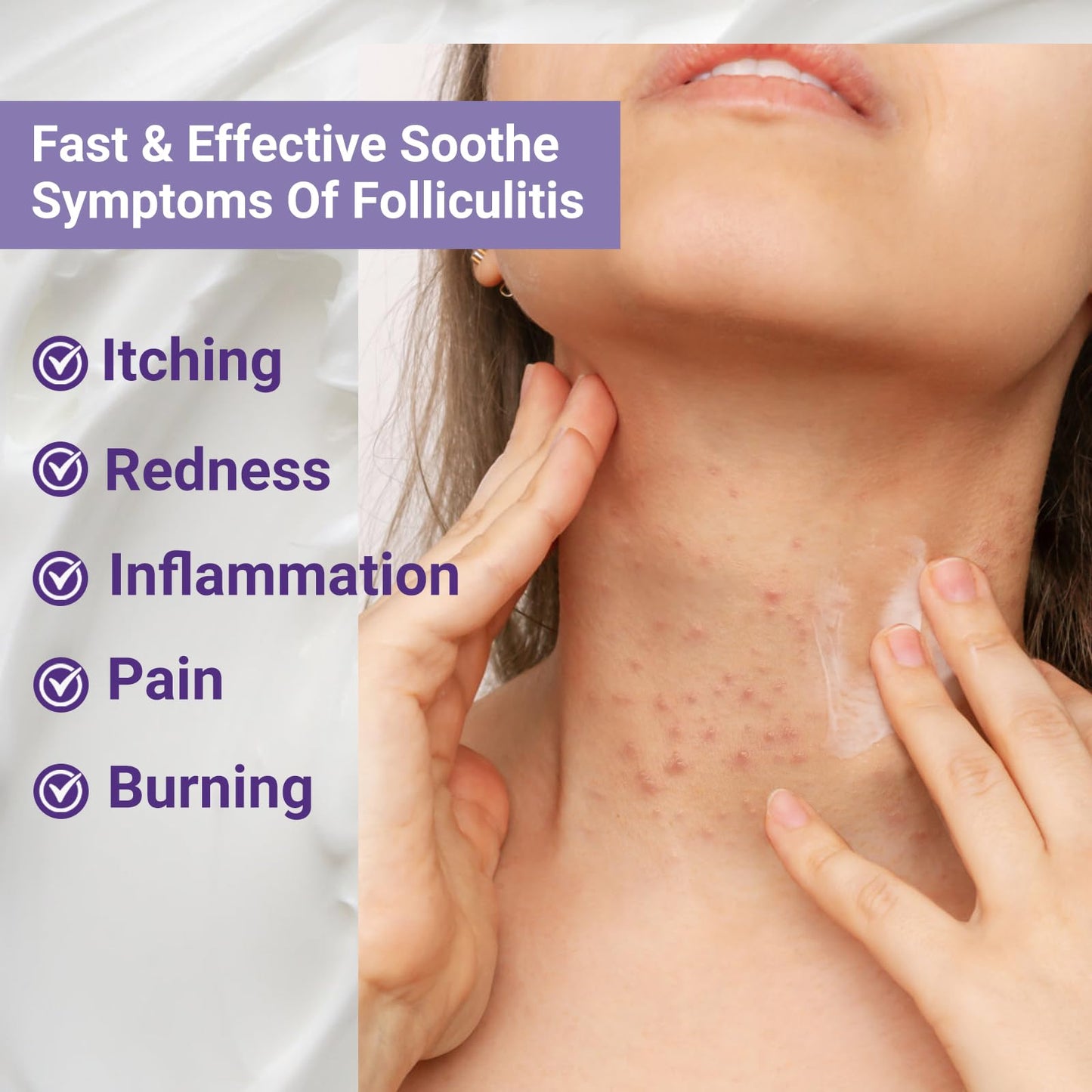 iShanCare Folliculitis Treatment, Highly Effective Folliculitis Cream, Natural Antibacterial Folliculitis for Itching, Redness, Inflammation, Pain, Burning, 353 Oz
