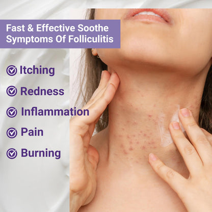 iShanCare Folliculitis Treatment, Highly Effective Folliculitis Cream, Natural Antibacterial Folliculitis for Itching, Redness, Inflammation, Pain, Burning, 353 Oz