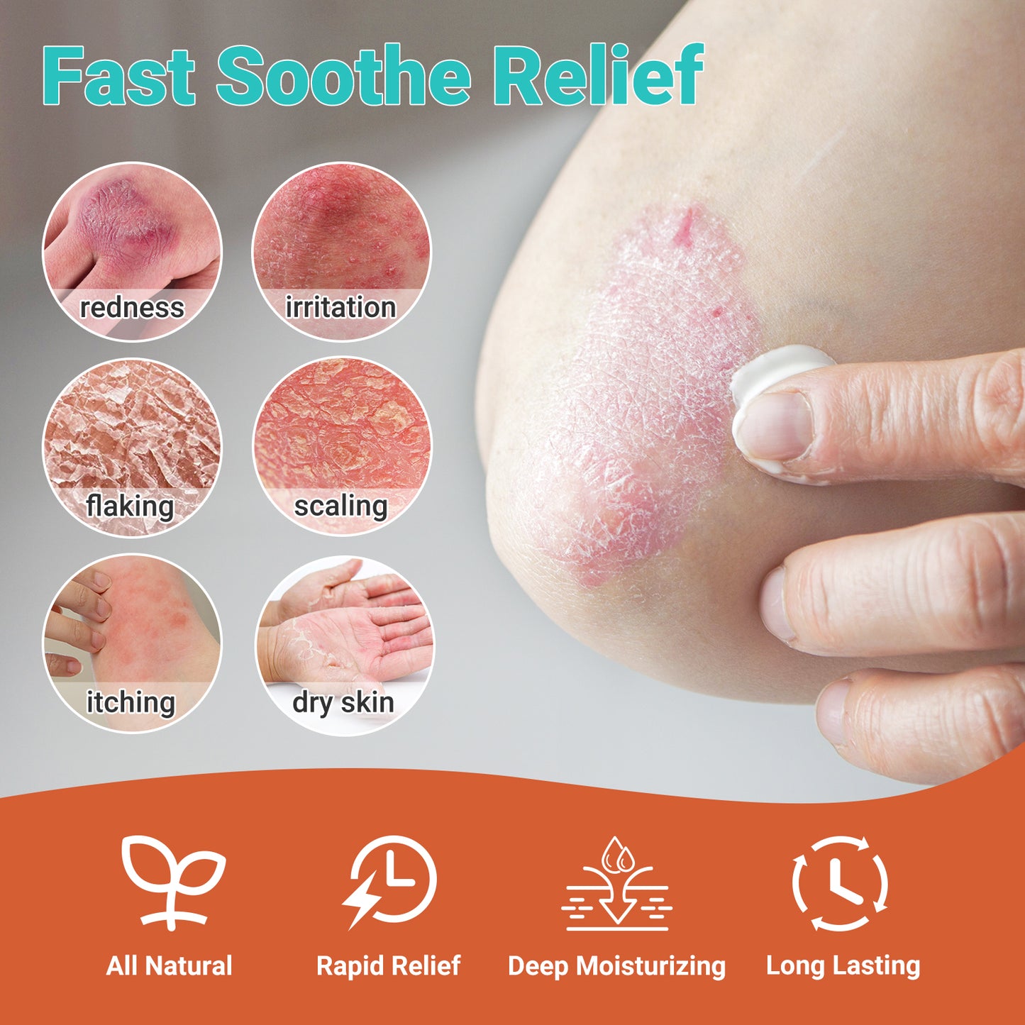 ishancare Psoriasis Cream, Potent Moisturizing Treatment Ointment for Psoriasis, Dermatitis & Rashes, Relief from Itching, Redness, Flaking & Scaling, Quick-Acting Soothing Cream for Dry Skin 3.53oz