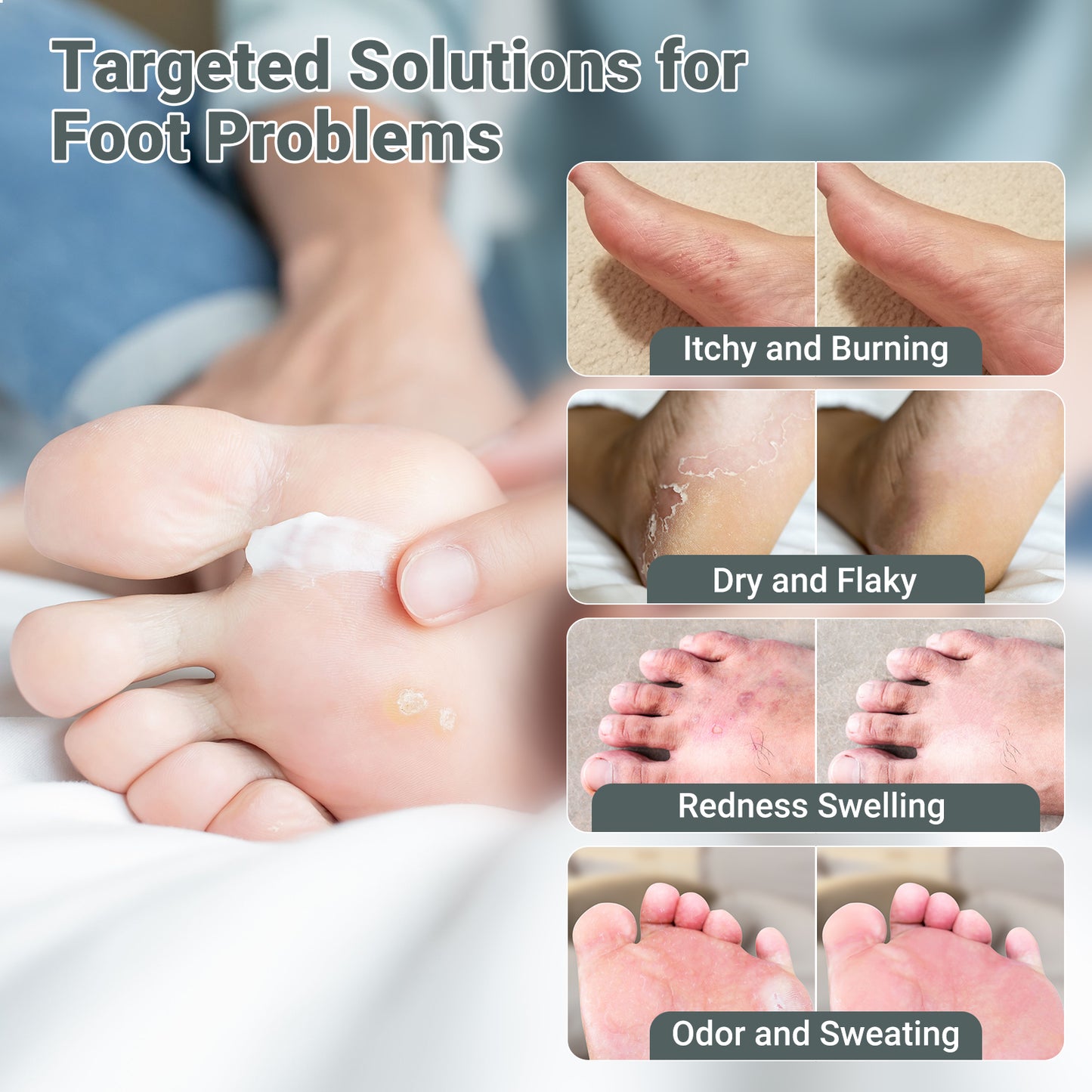 ishancare Extra Strength Antifungal Foot Cream (0.7oz) - Natural Herbal Treatment for Athlete's Foot - Relieves Itching, Burning, Cracking & Fungal Infections