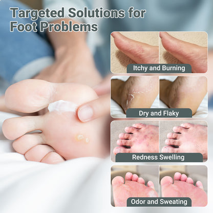 ishancare Extra Strength Antifungal Foot Cream (0.7oz) - Natural Herbal Treatment for Athlete's Foot - Relieves Itching, Burning, Cracking & Fungal Infections