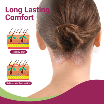 ishancare Seborrheic Dermatitis Cream, Maximum Strength Treatment for Psoriasis, Folliculitis, Dermatitis, Dandruff, Fast Relief for Itching, Redness, Irritation, Scaling, 3.53 Oz