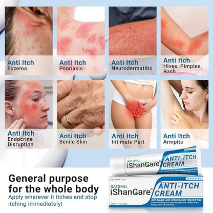 iShanCare® Anti Itch Cream, Maximum Strength Instant Itch Relief for Rash, Eczema, Bug/Mosquito Bites, Psoriasis, Poison Ivy, Dermatitis, Soothing Moisturizer for Dry, Sensitive Skin