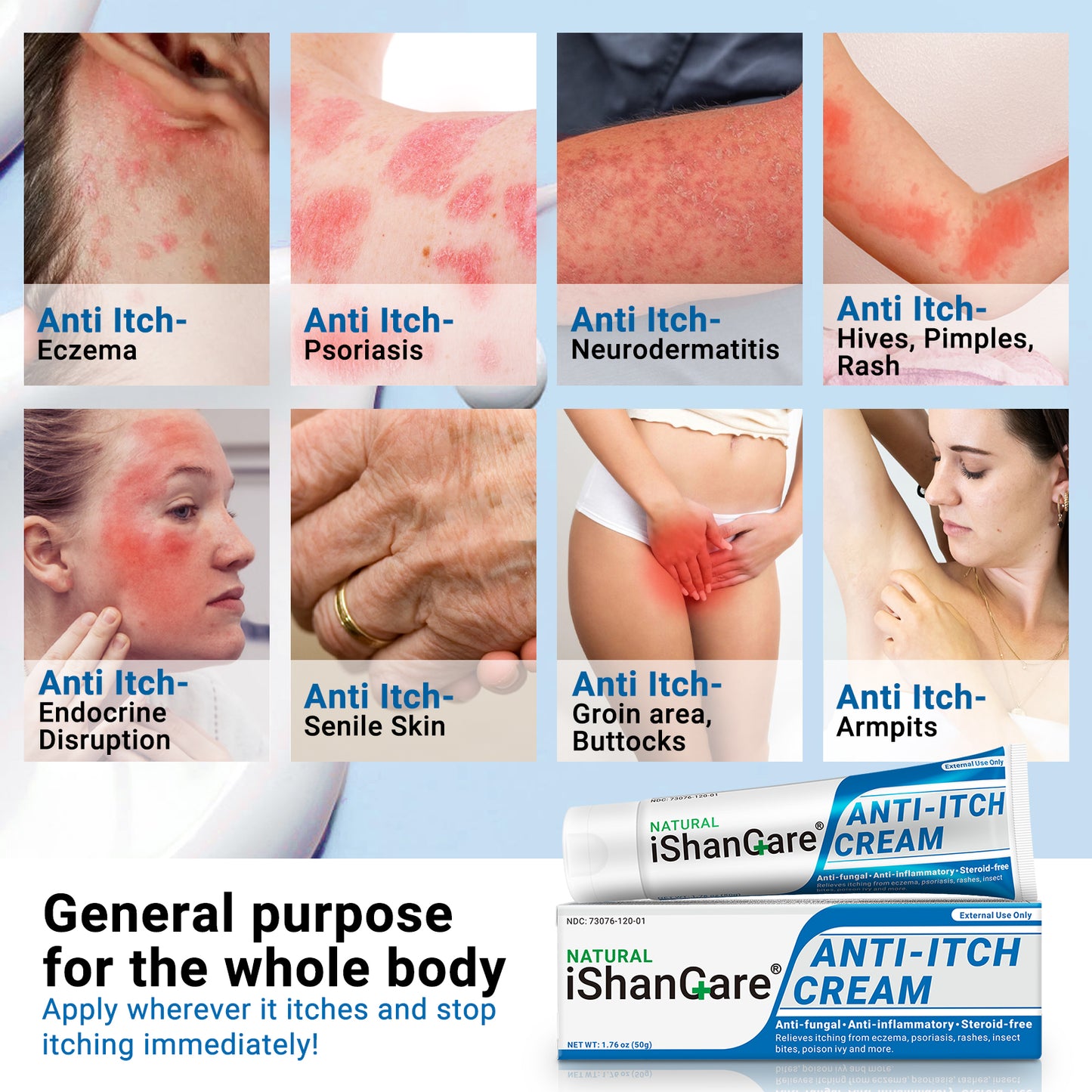 ishancare Anti Itch Soothing Cream Extra Strength Skin Itch Relief Ointment, for Full Body Itching Caused by Seasonal Changes, Dermatitis, Eczema, Rash, Psoriasis, Hives, Bites, Poison Ivy, 1.76 oz