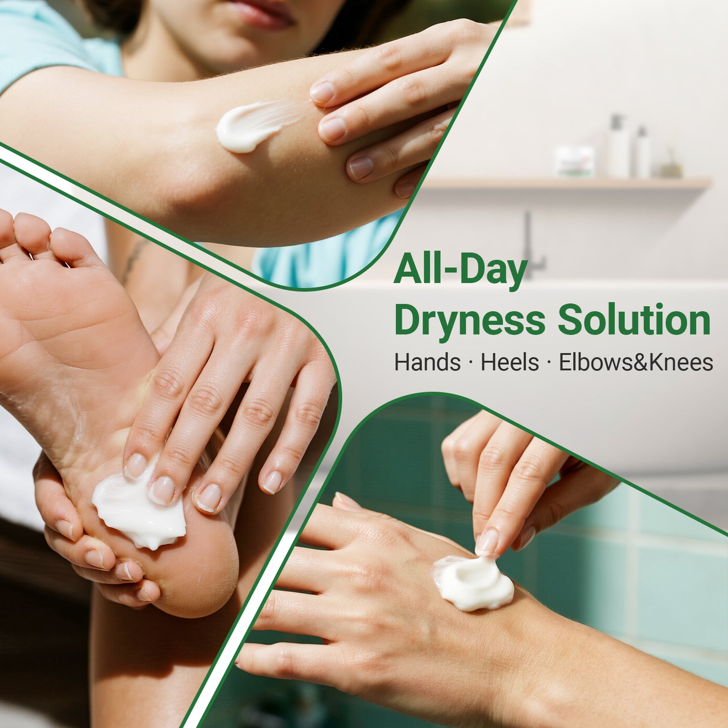 ishancare Cracked Skin Cream - Urea Intensive Repair & Moisturizing Treatment for Extremely Dry, Rough Hands and Cracked Heels - 200g Jar