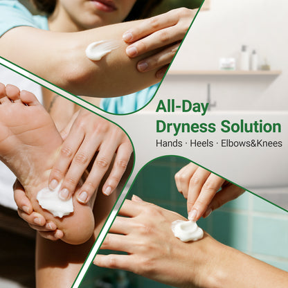 ishancare Cracked Skin Cream - Urea Intensive Repair & Moisturizing Treatment for Extremely Dry, Rough Hands and Cracked Heels - 200g Jar