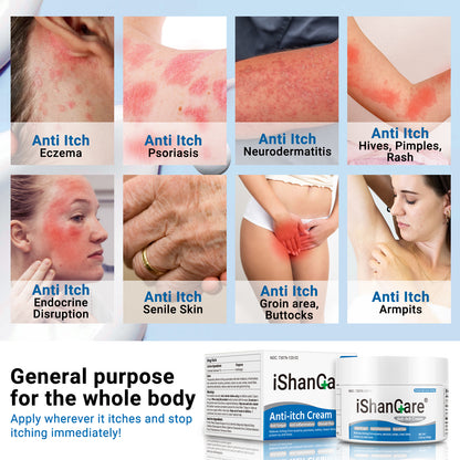 ishancare Anti Itch Cream Extra Strength, Oatmeal Soothing Skin Itch Relief Ointment for Rash, Dermatitis, Eczema, Psoriasis, Hives, Sun, Bites, Poison Ivy, Large Can 3.5 oz