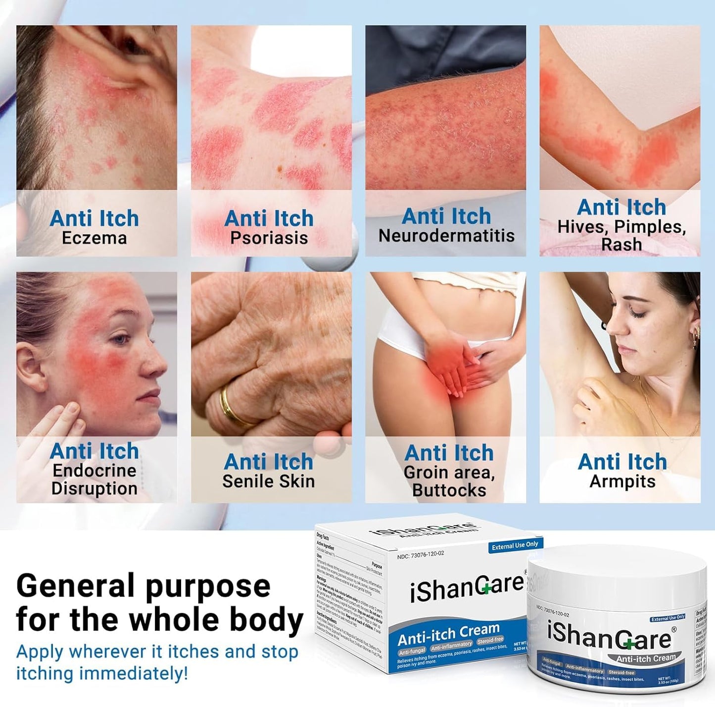 iShanCare® Anti-Juckreiz-Creme, maximale Stärke, sofortige Linderung von Juckreiz bei Hautausschlag, Ekzemen, Insekten-/Mückenstichen, Psoriasis, Poison Ivy, Dermatitis,beruhigende Feuchtigkeitscreme