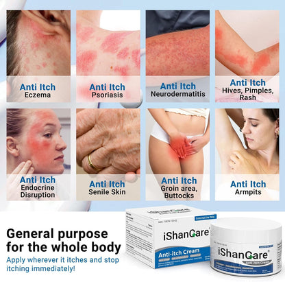 iShanCare® Anti-Juckreiz-Creme, maximale Stärke, sofortige Linderung von Juckreiz bei Hautausschlag, Ekzemen, Insekten-/Mückenstichen, Psoriasis, Poison Ivy, Dermatitis,beruhigende Feuchtigkeitscreme