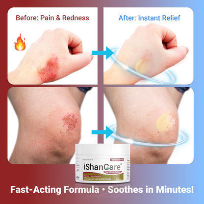ishancare Burn Ointment with Camellia Oil, Fast-Acting Natural Relief for Burns, Sunburns, Cuts & Scrapes, Ensitive Skin Safe, 1.76oz
