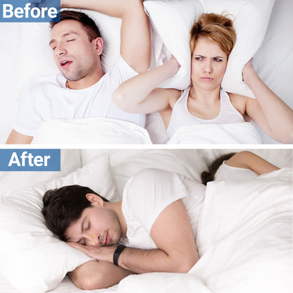 ishancare Nasal Strips for Breathing, 30 Count Sleep Nasal Strips for Snoring, Instant Tan Nose Breathing Strips for Better Sleep, Anti Snoring Nose Strips for Men & Women