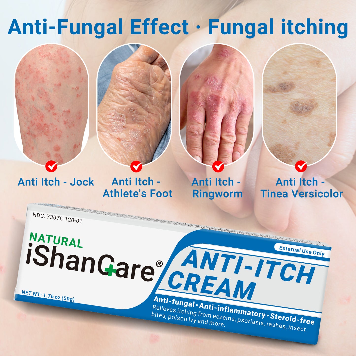 ishancare Anti Itch Soothing Cream Extra Strength Skin Itch Relief Ointment, for Full Body Itching Caused by Seasonal Changes, Dermatitis, Eczema, Rash, Psoriasis, Hives, Bites, Poison Ivy, 1.76 oz