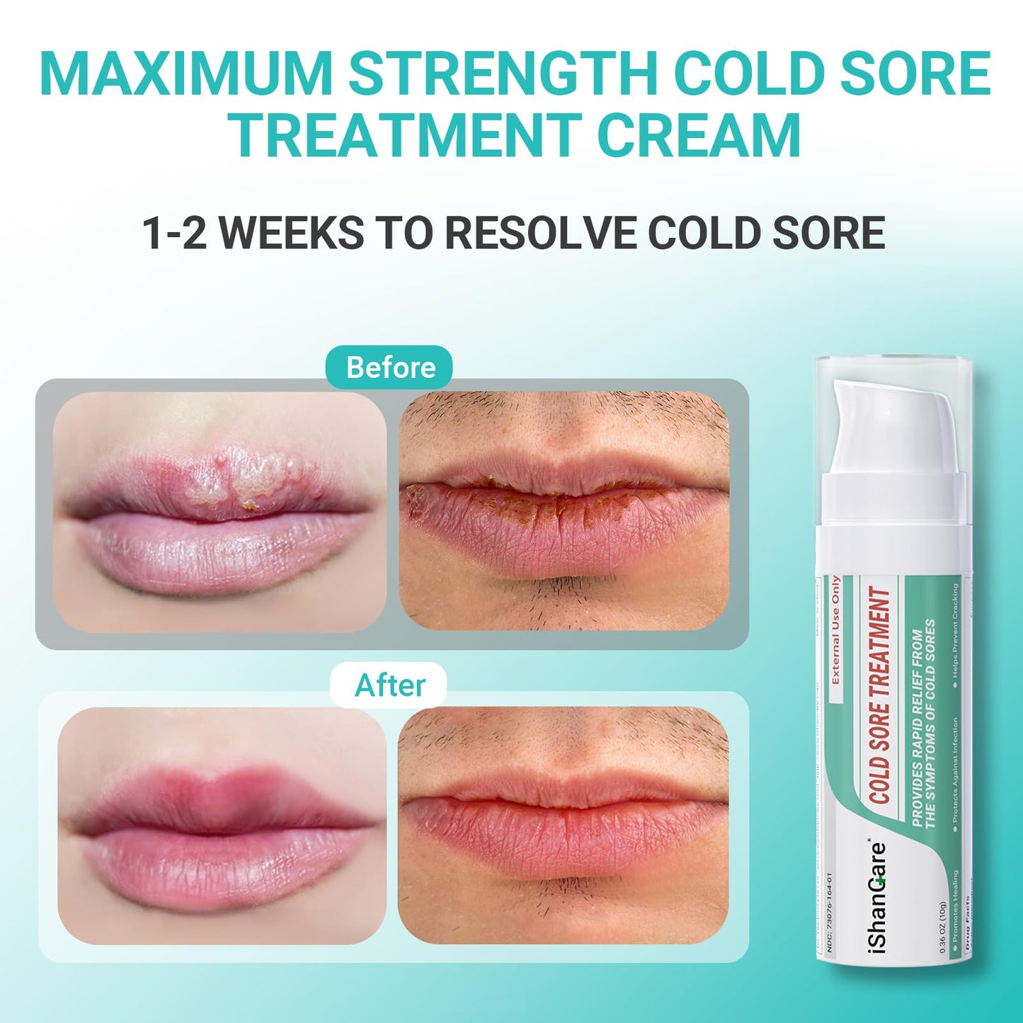 ishancare Cold Sore Treatment Cream, Fast Relief, Soothing Moisture, Portable & Hypoallergenic Formula for Healthy Lips 0.36oz（10g）