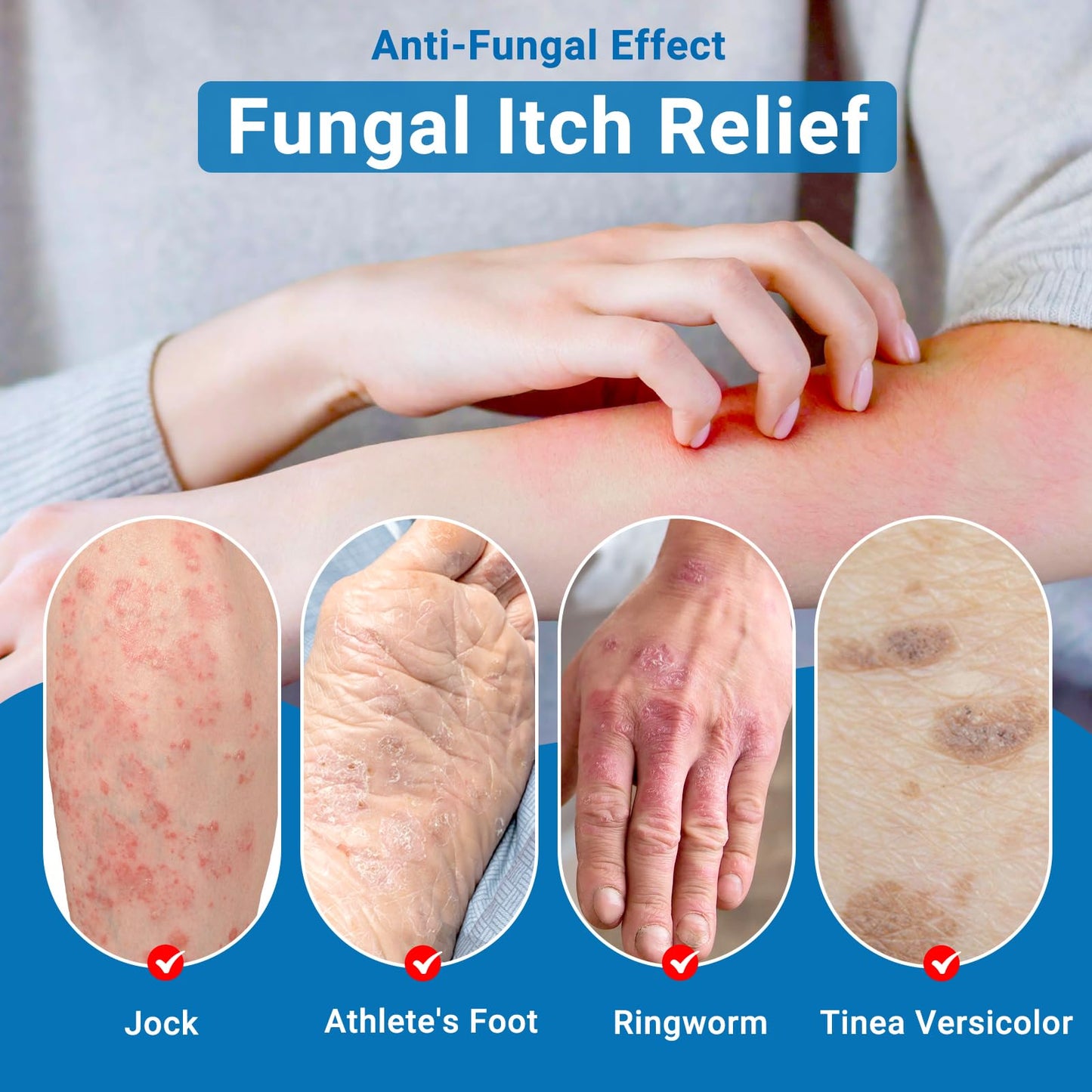 Anti Itch Cream Extra Strength, Oatmeal Soothing Skin Itch Relief Ointment for Rash, Dermatitis, Eczema, Psoriasis, Hives, Sun, Bug&Mosquito Bites, Poison Ivy, Large Can 3.5 oz