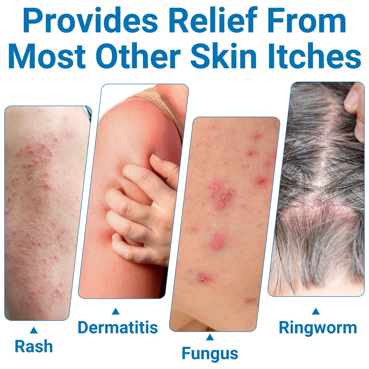 ishancare Anti Itch Cream Extra Strength, Outdoor Portable Itchy Skin Relief Cream for Bug & Mosquito Bites, Insect Bites, Poison Ivy and More Itches, Contains Skin Protecting Oatmeal 0.7oz