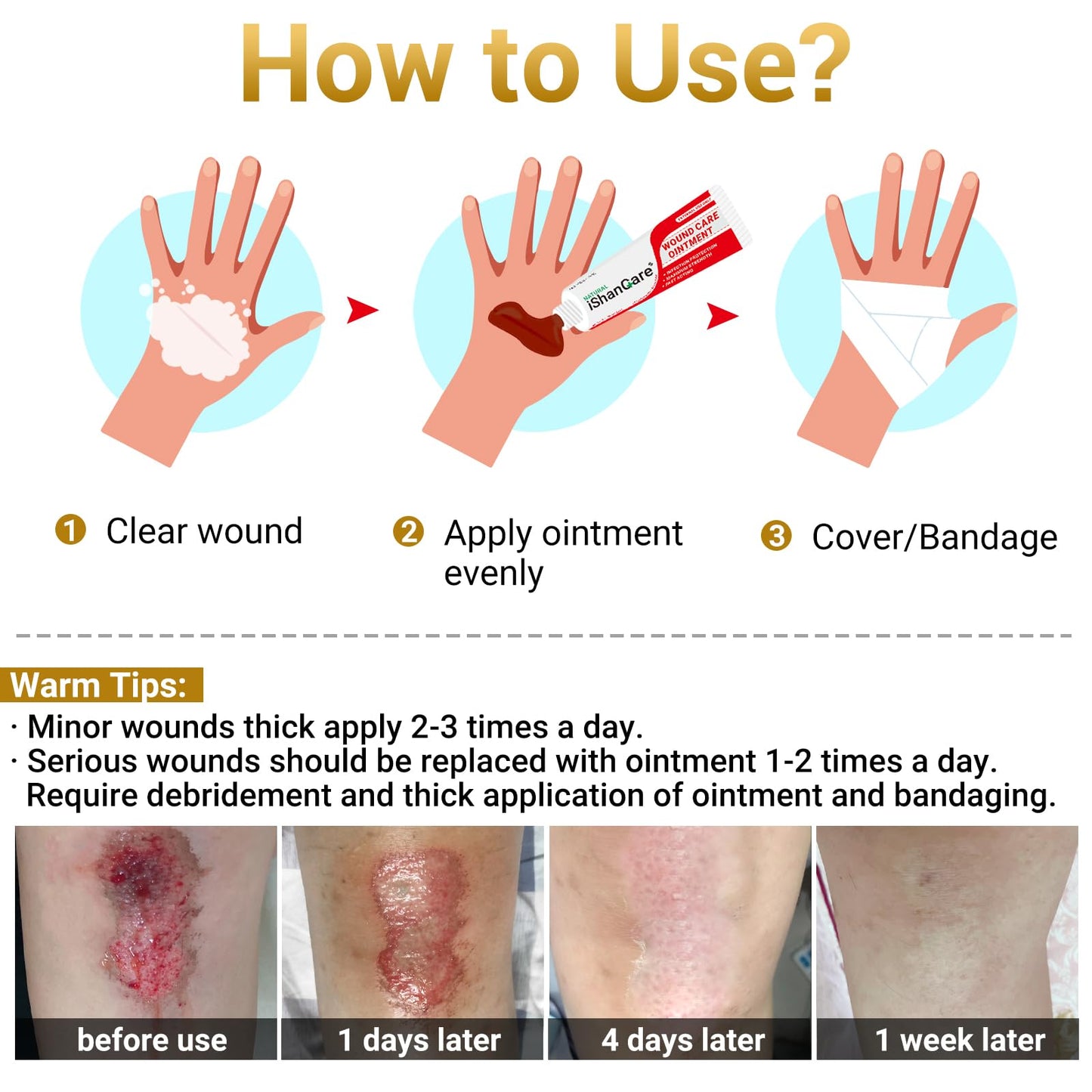 iShanCare® Wound Care Ointment - Maximum Healing for Cuts, Gash, Scratch, Stab, Traumas, Bite, Abrasions, Bed sores, Pressure Sores, Ulcers, Leg and Foot Wounds, Natural Wound Healing Ointment