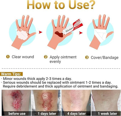 iShanCare® Wound Care Ointment - First Aid Ointment, 3X Faster Healing for Burns, Ulcers, Cuts, Abrasions, Bed sores, Pressure sores, Leg and Foot Wounds, Natural Wound Healing Ointment