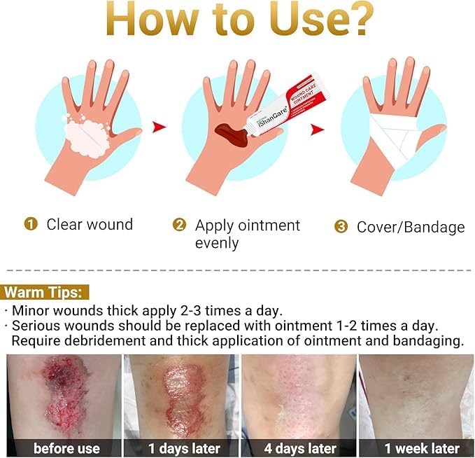 iShanCare® Wundpflegesalbe - Abschürfungen, Dekubitus, Druckgeschwüre, Bein- und Fußwunden, natürliche Wundheilungssalb,3X schnellere Heilung für Verbrennungen, Geschwüre, Schnitte, Erste-Hilfe-Salbe