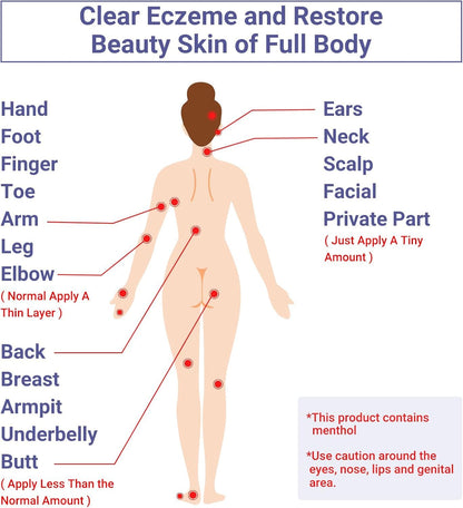 Ekzem-Creme, Ekzem-anfällige Haut beruhigende & feuchtigkeitsspendende Behandlung Salbe für den ganzen Körper Ausschlag, Psoriasis, Dermatitis, Urtikaria, Rötung, Juckreiz, Trockenheit, Krustenbildung