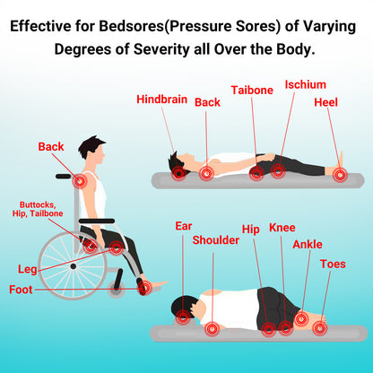 ishancare® Bed Sore Cream - Fast & Safe Natural Healing Pressure Sore Cream, Bedsore Wound Care Healing Ointment, Treatment for Bed sores Pressure Sores Diabetic Ulcer Wounds Burns and Cuts