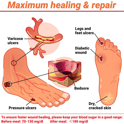 iShanCare® Diabetic Wound Ulcer Cream - First Aid Healing Ointment, Natural Protective Ointment for Leg & Foot Ulcers, Venous Ulcers, Bed Sores, Pressure Sores and Septic Wounds
