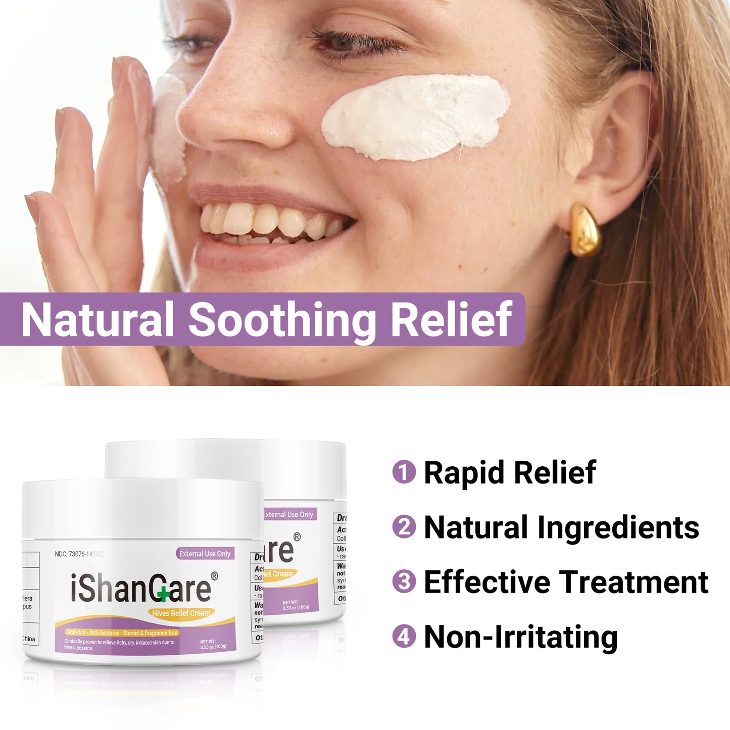 ishancare Urticaria Cream, Fast Acting Relief of Hives, Allergic Rashes, Itchy Skin, Redness, Swelling, Anti Fungal Hives Cream with All Natural Herbal Ingredients, 3.53 Oz